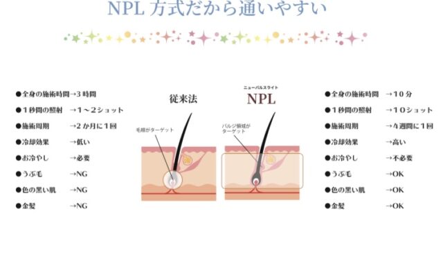 ☆Cuoreの美肌脱毛機☆