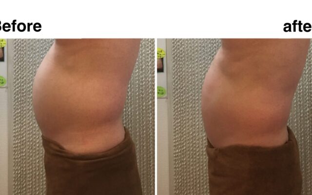 50代男性☆Before after