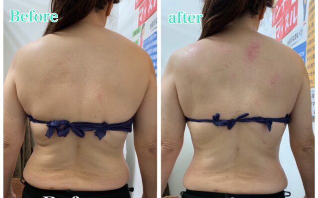 はみ肉よ！さよ〜なら