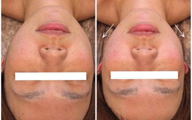 ぷるるん美肌☆スッキリ小顔！